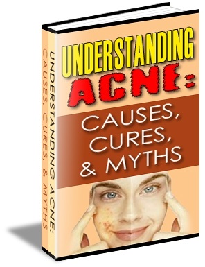 Understanding Acne: Causes, Cures & Myths